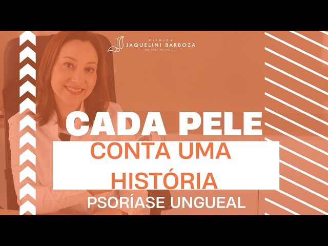 "Cada pele conta uma história" - Psoríase Ungueal