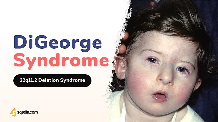 DiGeorge Syndrome Pathophysiology | 2-Minute Neurology Video | V-Learning™