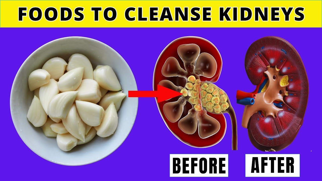 5 Foods That Will CLEANSE Your Kidneys FAST / SimoHealth - YouTube