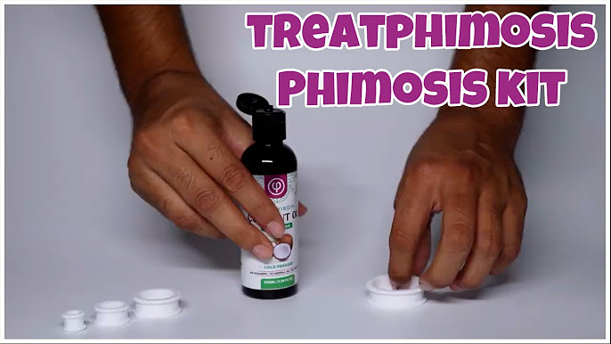 Treatphimsosis Phimosis Kit: Foreskin Stretching Exercise Kit