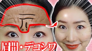 Removing Forehead & Frown Wrinkles Massage & Exercises Without Botox