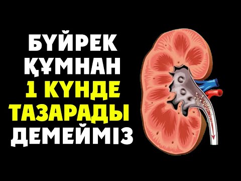 Бейне: Шайдың қалай екенін білейік: классификация