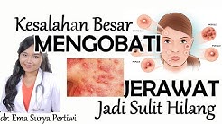 Kesalahan Besar saat Mengobati Jerawat #acne2 | dr. Ema Surya P - Durasi: 9.27. Kesalahan Besar saat Mengobati Jerawat #acne2 | dr. Ema Surya P - Durasi: 9.27.