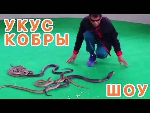 УКУС КОБРЫ! НЕ ДЛЯ СЛАБОНЕРВНЫХ!!! УКУС КОБРЫ! НЕ ДЛЯ СЛАБОНЕРВНЫХ!!!