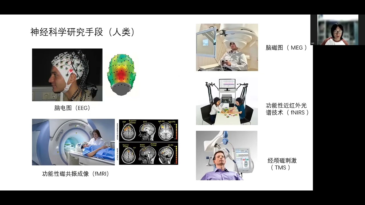 揭开神经文本的神秘面纱