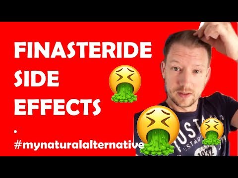 finasteride side effects go away reddit