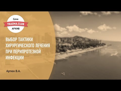 Видео: 12 общих вопросов по коленной хирургии