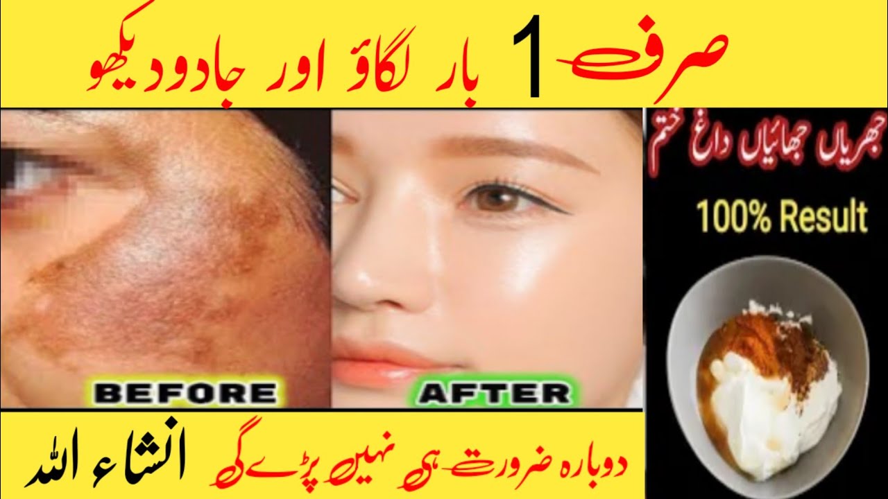 One day Whitening challenge | Face pack for glowing skin Homemade # ...