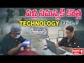 పళ్ల సమస్యకి కొత్త Technology నొప్పి లేకుండా Problem solve #dental #dentalclinic #hyderabad