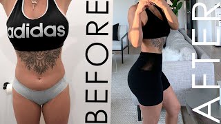 I got a Brazilian butt lift in Mexico... here's what happened