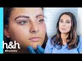 Implante de cejas le devuelve la expresión natural a su rostro | Cirugías Milagrosas | Discovery H&H