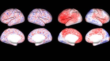 Visualization of brain activity, with and without tNLM filtering - Whole brain
