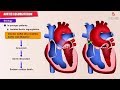 Aortic regurgitation / Aortic insufficiency : Etiology , Pathology , Diagnosis  and Treatment- USMLE