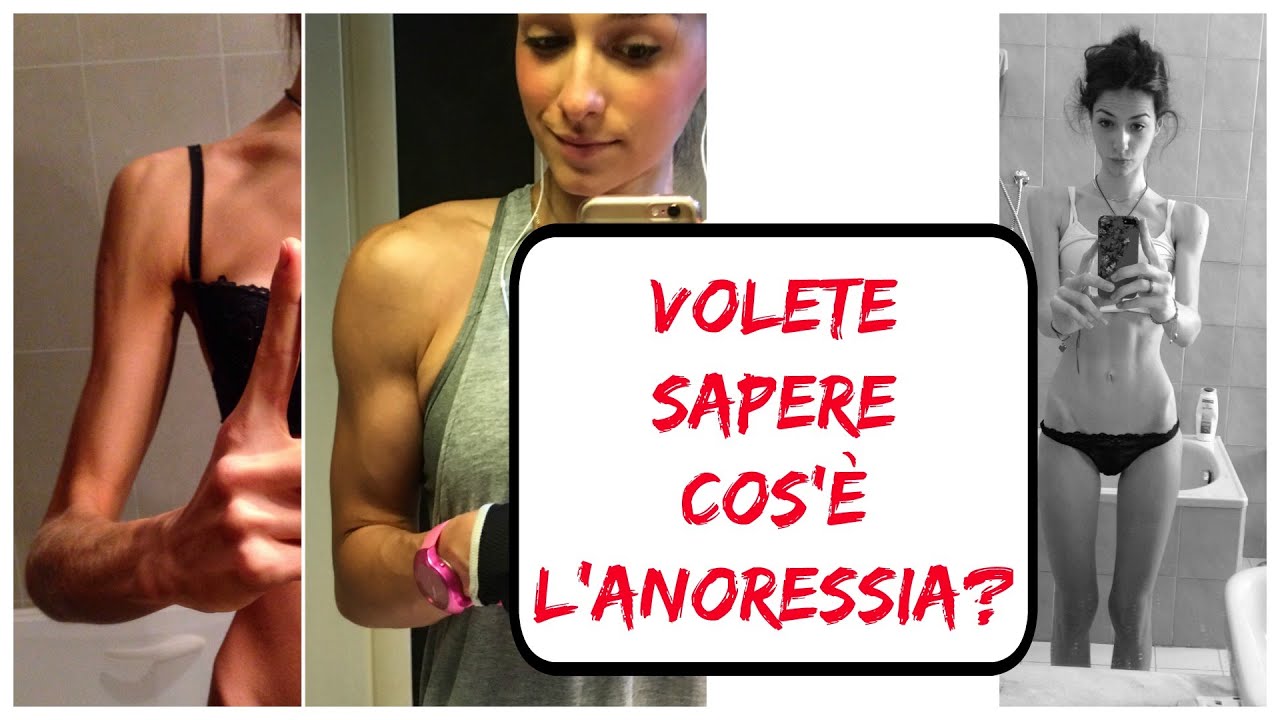 VOLETE SAPERE COS’È L’ANORESSIA? Dall’Anoressia Alla Vita YouTube VOLETE SAPERE COS’È L’ANORESSIA? Dall’Anoressia Alla Vita YouTube