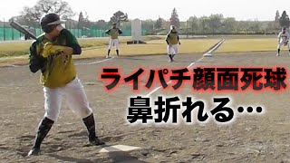 ライパチが顔面デッドボールで鼻骨折…軟式でも折れた。