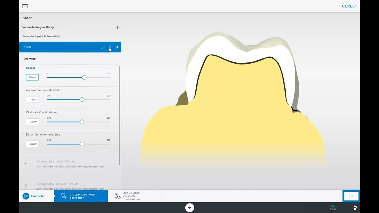 CEREC Software 5: Das Systemmenü