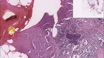 Digital Pathology Viewer