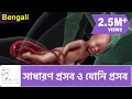 NORMAL LABOR & VAGINAL BIRTH | Bengali