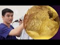 ASMR耳掃除:バイノーラル録音で感じる究極のリアリズム🎧