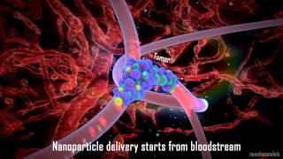 Nanoparticle drug delivery in cancer therapy