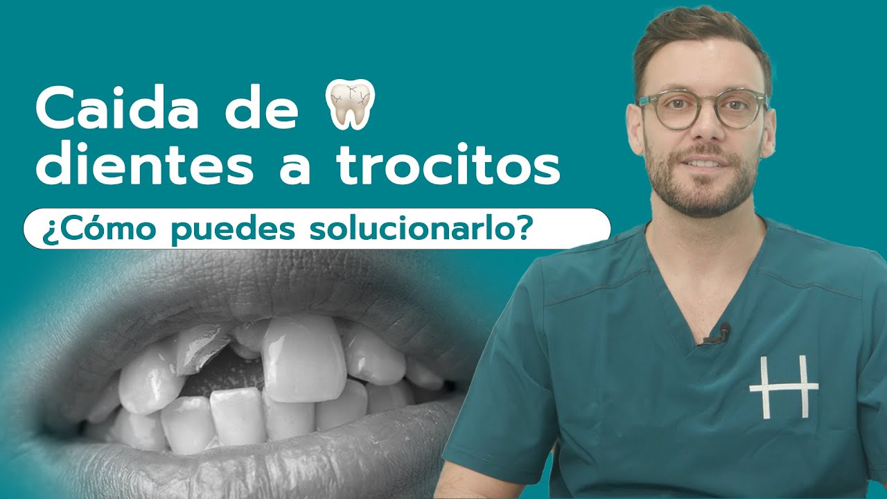 ¿SE TE CAEN LOS DIENTES a TROCITOS? 🚨 Ojo con esto | Hinboca Clínica Dental ©