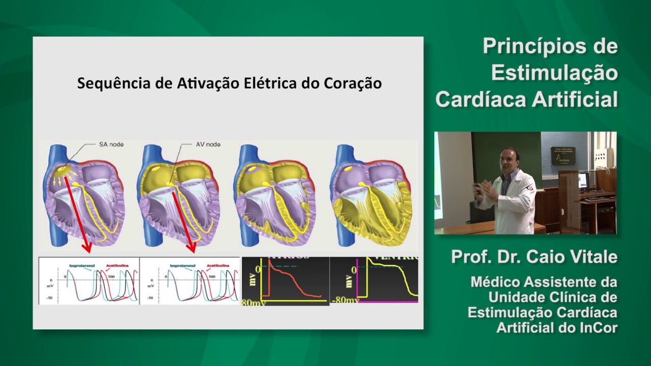 Princípios de Estimulação Cardíaca Artificial - Prof Dr Caio Vitale