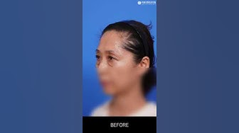 라봄성형외과 - YouTube 라봄성형외과 - Youtube