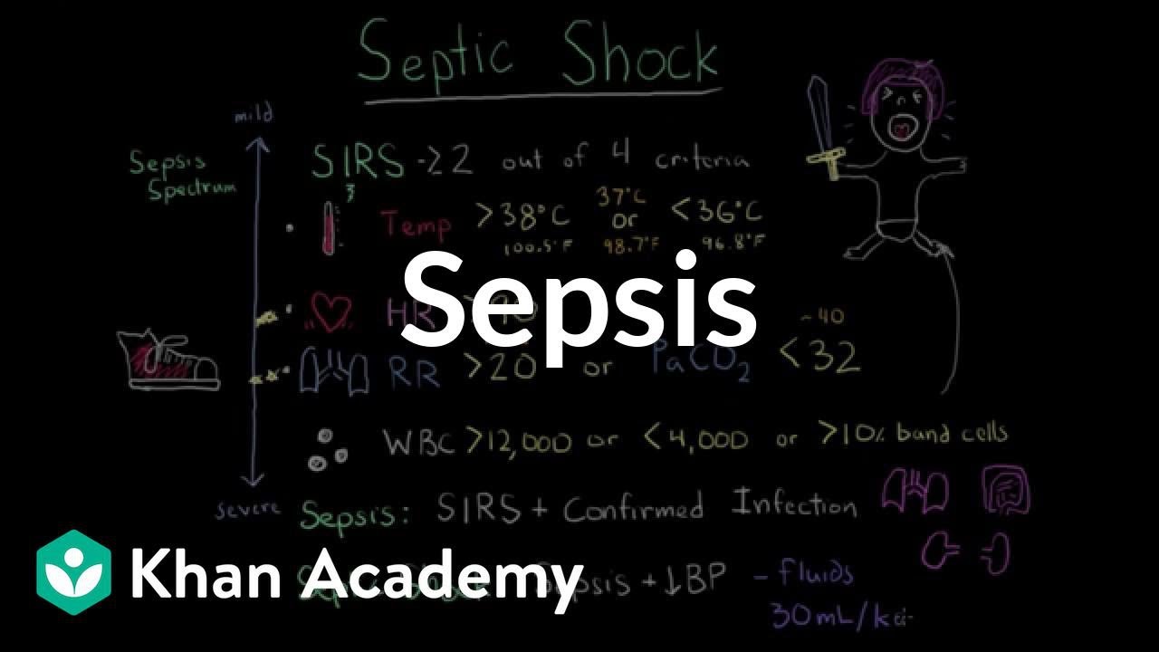 Download Sepsis: Systemic inflammatory response syndrome (SIRS) to multiple organ dysfunction syndrome (MODS)