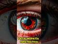 Hipertiroidismo. EGB.  #medicina #tiroides #hipertiroidismo #autoinmune #oftalmologia #hormones