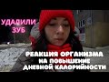 Как реагирует организм на повышение калорий и зачем я это делаю / Буду ставить имплант