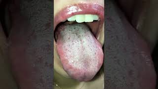 Woman Tongue-9 Age 30