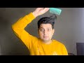 My hair transplant results 2023  my diet plan after hair transplant  my hair transplant journey