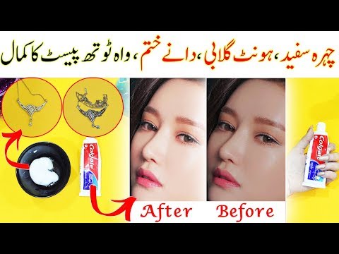 5-magical-beauty-hacks-&-life-hacks-using-toothpaste--pimples,dark-lips-,-blackheads-&-rusty-jewelry