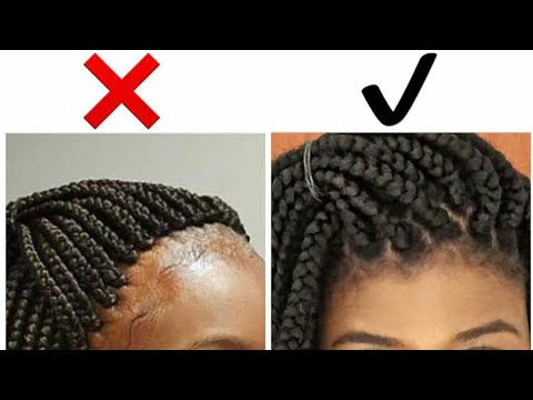 Tight braids? How to loosen tight braids!! - YouTube