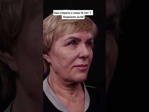 На сколько стала моложе? Фейслифтинг. Доктор ЕГОРОВА М.В.