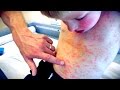 IMPRESSIVE FULL BODY RASH! | Live Diagnosis With Dr. Paul