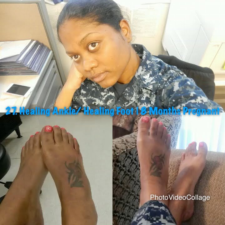 27. Healing Ankle After Crutches 3132 Weeks Pregnant. YouTube