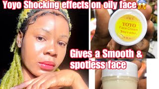 Yoyo Face cream review.  #skincare  #lighteningfacecreams