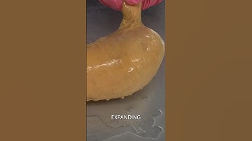 How Big is the Human Stomach?