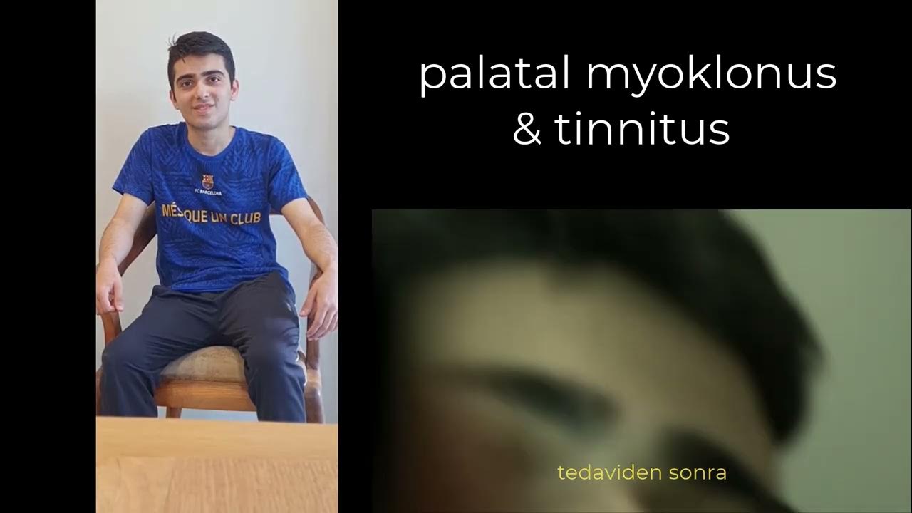 PALATAL MYOCLONUS ( Palatal tremor) YouTube