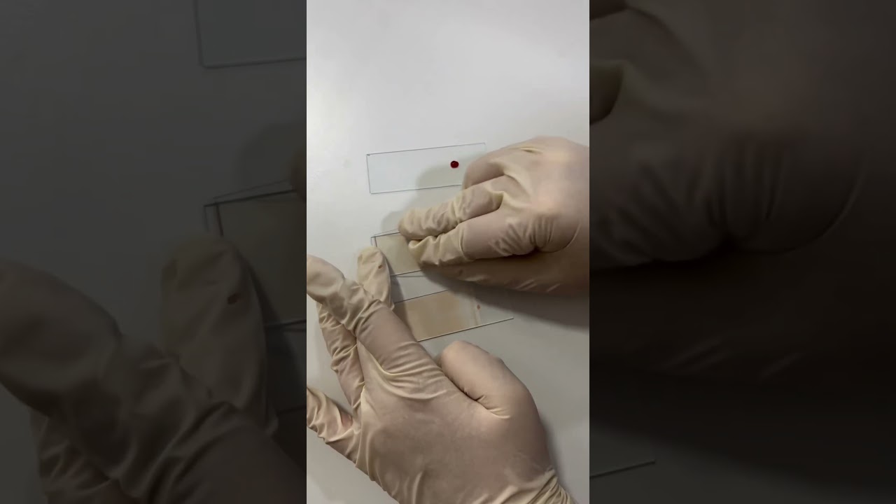 Who says perfect smear doesn’t exist?/life of medico 