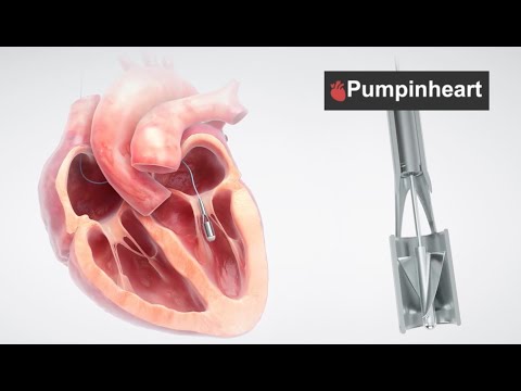 Spark - Pumpinheart Presentation video - video from Spark Crowdfunding