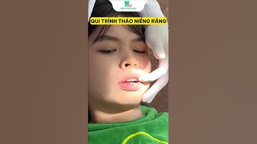 Có nên tháo mắc cài tại nhà không