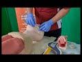 Airway breathing management