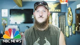 Former Skinhead Seeks Redemption By Covering Hateful Tattoos For Free | NBC News