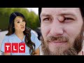 Ein Mann mit einem dritten Auge | Dr. Pimple Popper | TLC Deutschland