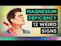 12 strange signs your body needs magnesium