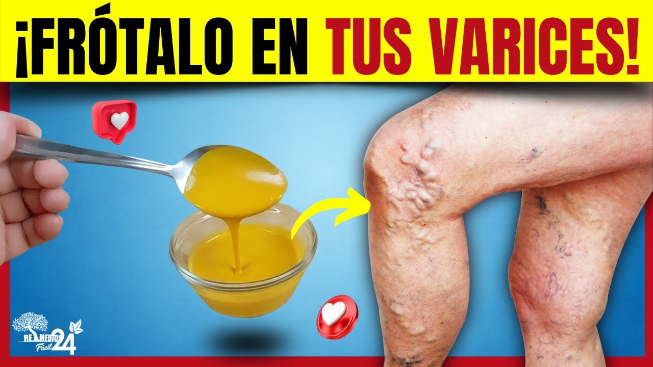 Que tomar para la cistitis sin receta