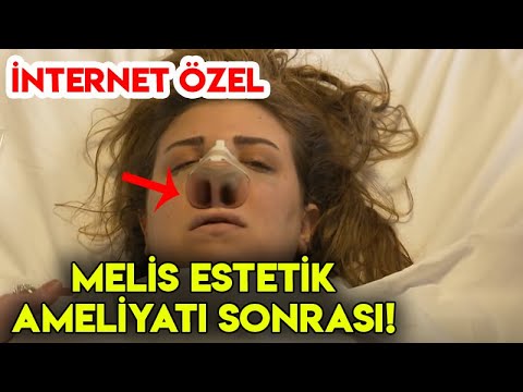 Video: Olga Ostroumova: 72 Yaşındaki Bir Sovyet Aktris Bugün Estetik Ameliyattan Sonra Neye Benziyor?