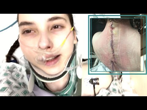 Vlogging with EDS: Radical Change of Plans During Spinal Surgery | Week 68